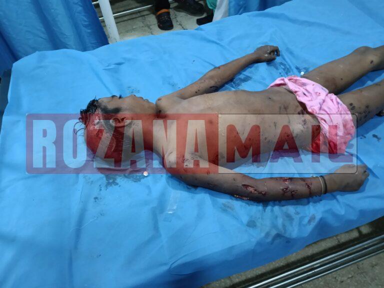 जालंधर में कुत्तों के झुंड ने आठ साल के बच्चे को नोच खाया, शरीर के कई हिस्सों पर काटा, मौत